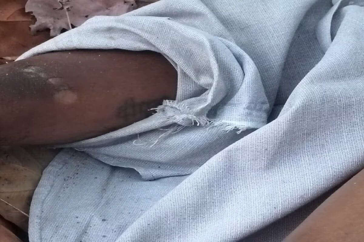 भूतिया नाला के समीप सड़क किनारे एक व्यक्ति का शव मिलने से इलाके में सनसनी, सिर पर गंभीर चोट के निशान